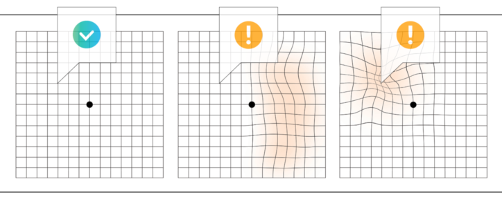 Пример теста Амслера